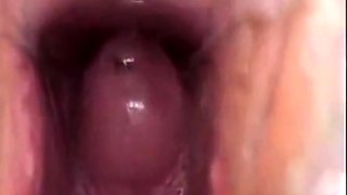 Girl's Tiring Doctor Visit A Webcam Capture