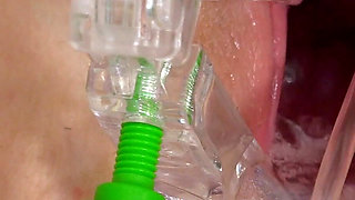 Super Cute Redhead Kaira Love Gets Her Cervix Examined with Speculum