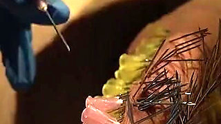 107 Needles CBT